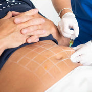 Online Fat Dissolving Injections