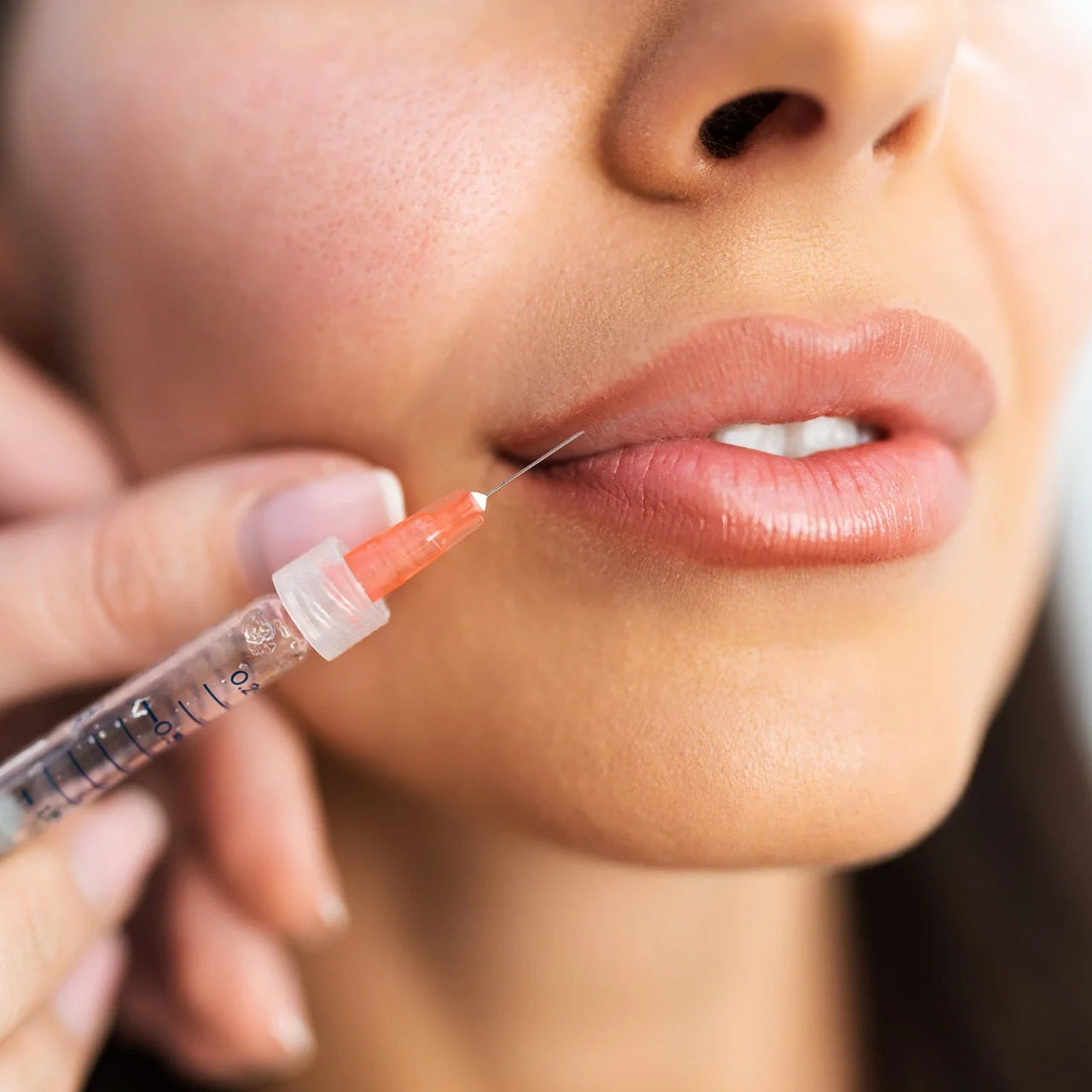 Online Lip Fillers